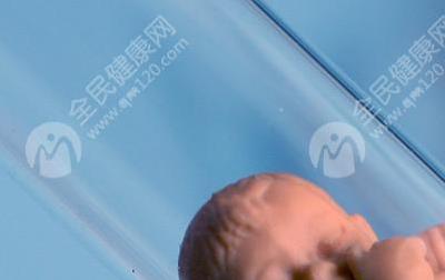 宝鸡大概需要多少钱做第三代试管婴儿，医院有哪些？